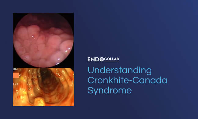 Cronkhite Canada Syndrome (Ccs)