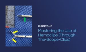 Polypectomy Clips Mastering The Use Of Hemoclips (Through-The-Scope-Clips) - EndoCollab