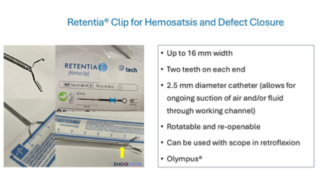 Tools Of The Trade: The Retentia ® Clip