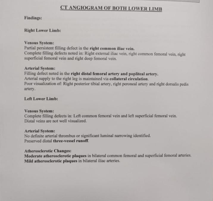 Upadacitinib Complication Case With Pe/Dvt In Bedridden Crohn'S Patient