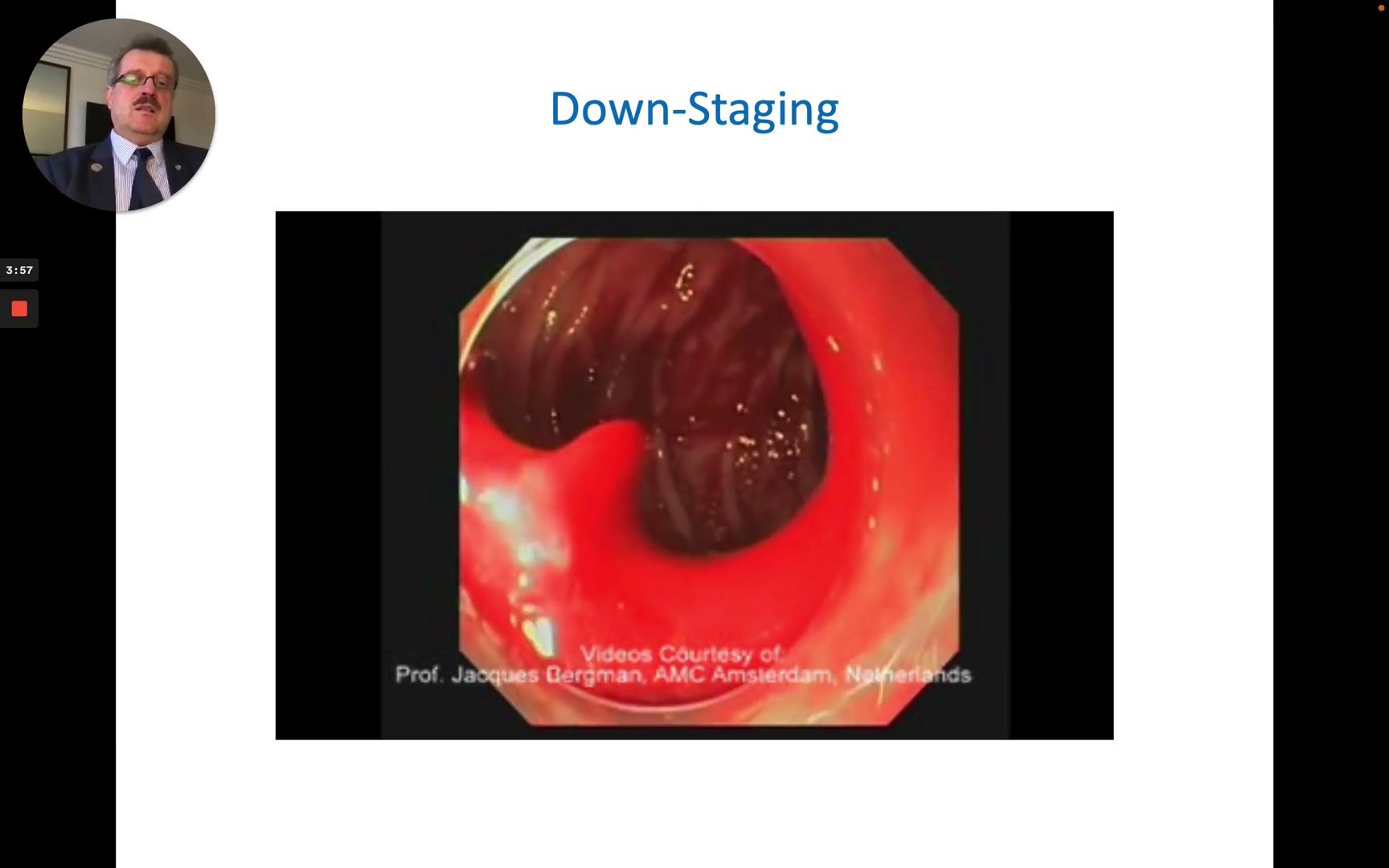 Hemostatic Powders: A Modern Tool For Gastrointestinal Bleeding 2 Hemostatic Powders Lecture - Key Frame 2