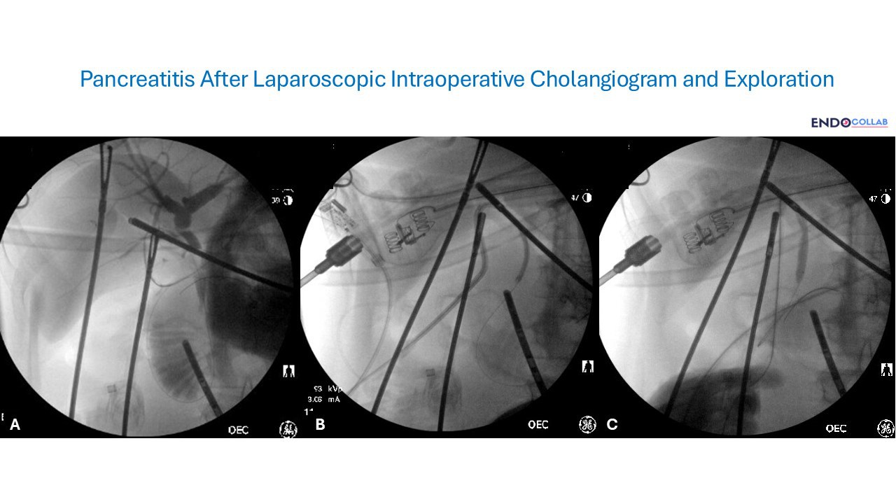 Gi Endoscopy Community &Amp; Education - Endocollab