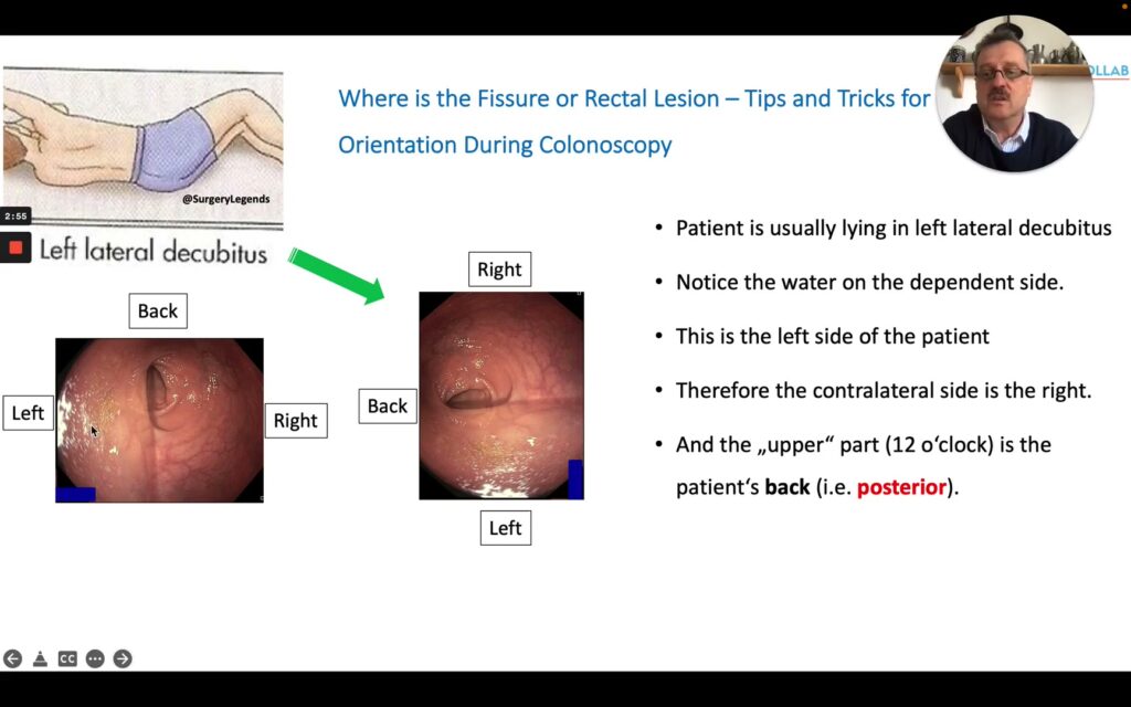 Anorectal Orientation Coordinate Map Showing Anterior, Posterior, Left, And Right