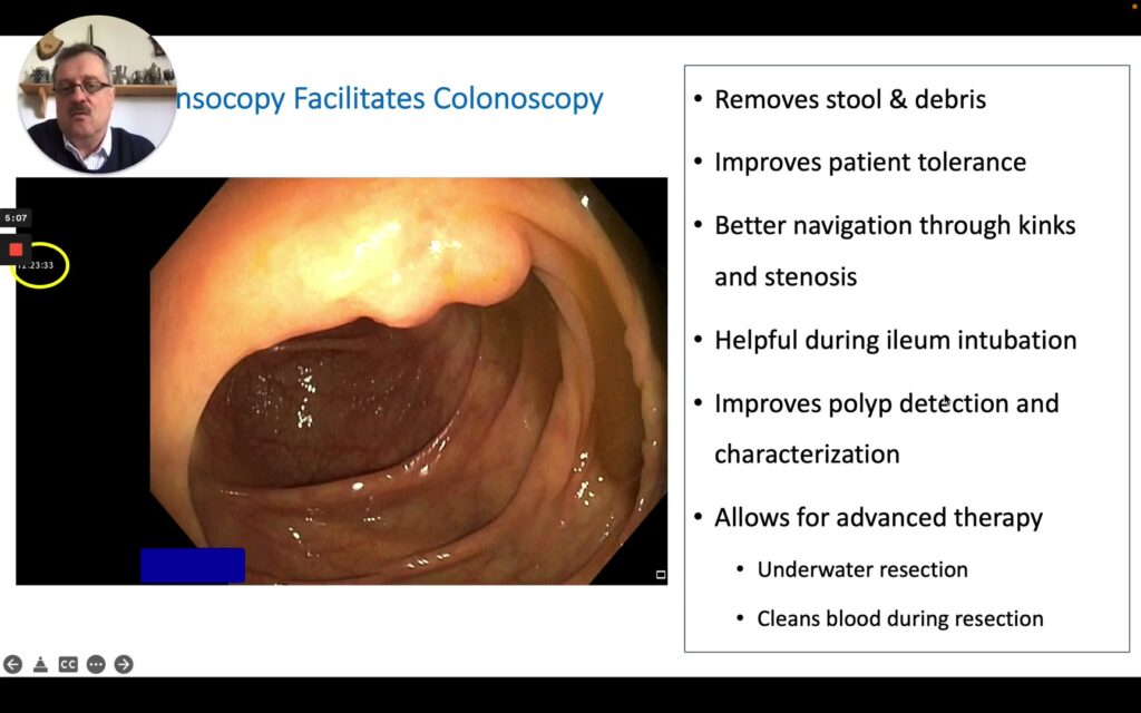 Endoscopic view of colon lumen during hydrocolonoscopy