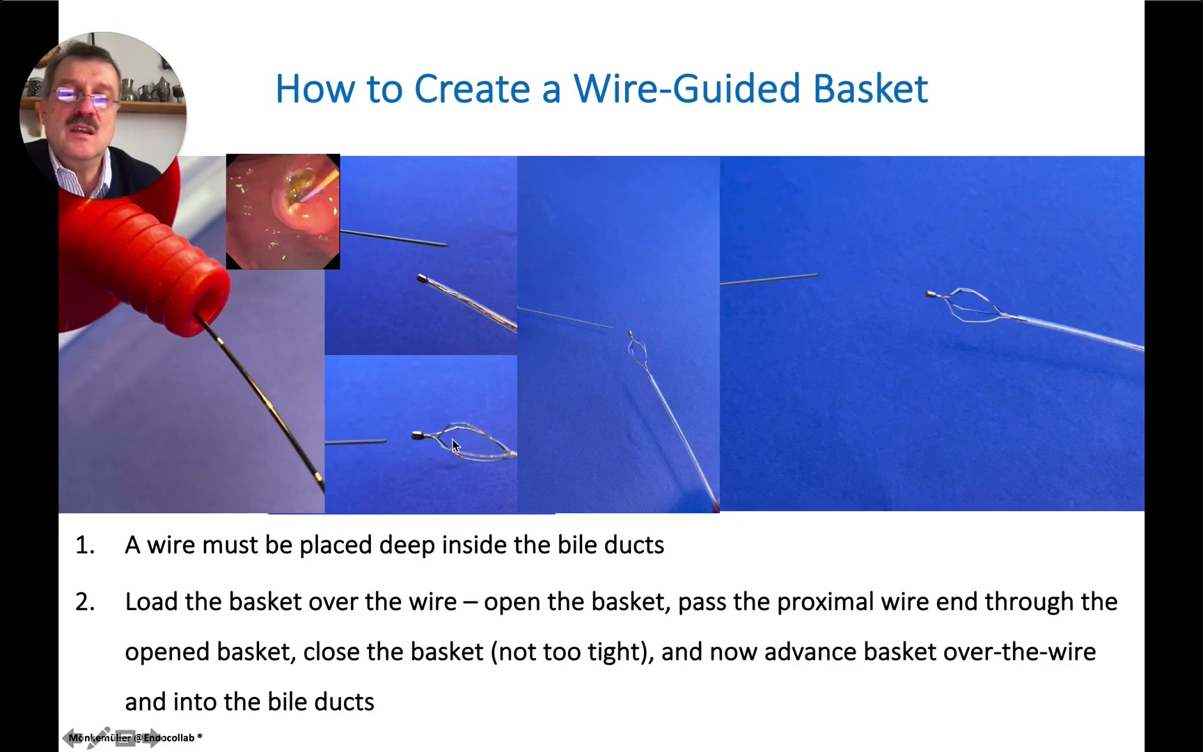 Step Sequence For Loading A Standard Stone Basket Over A Guidewire