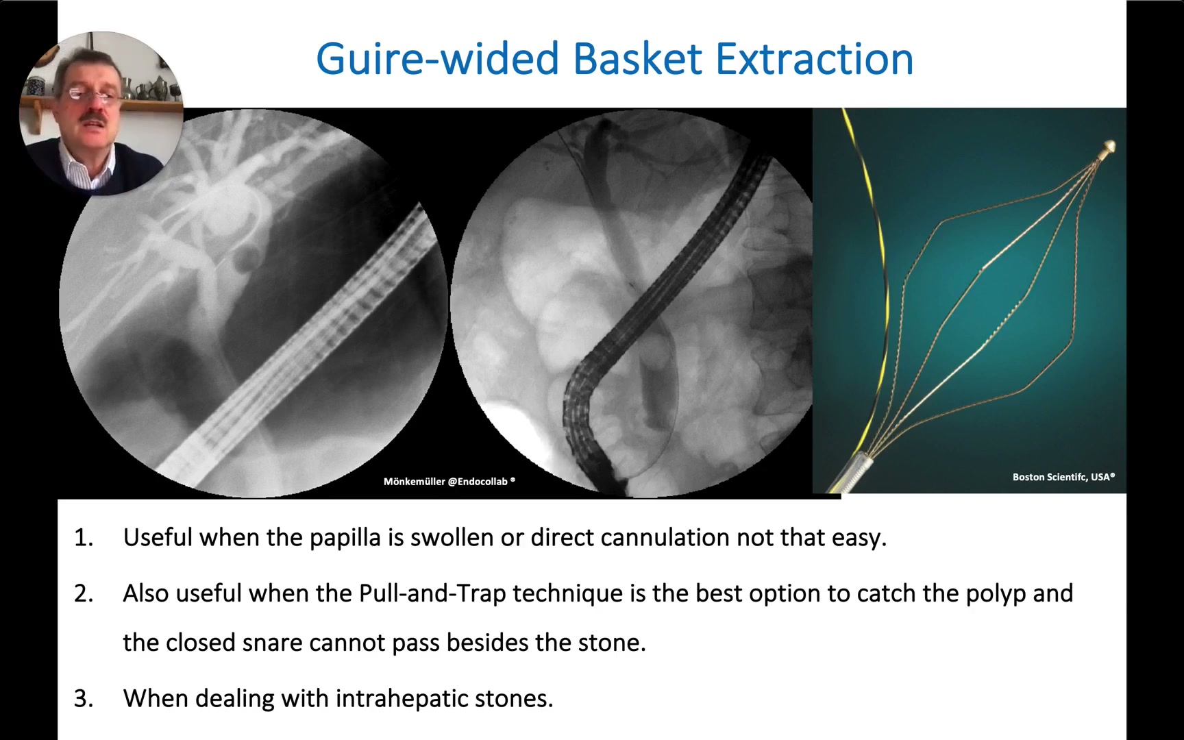 Three Rules For Guidewire-Aided Basket Extraction With Basket Photo