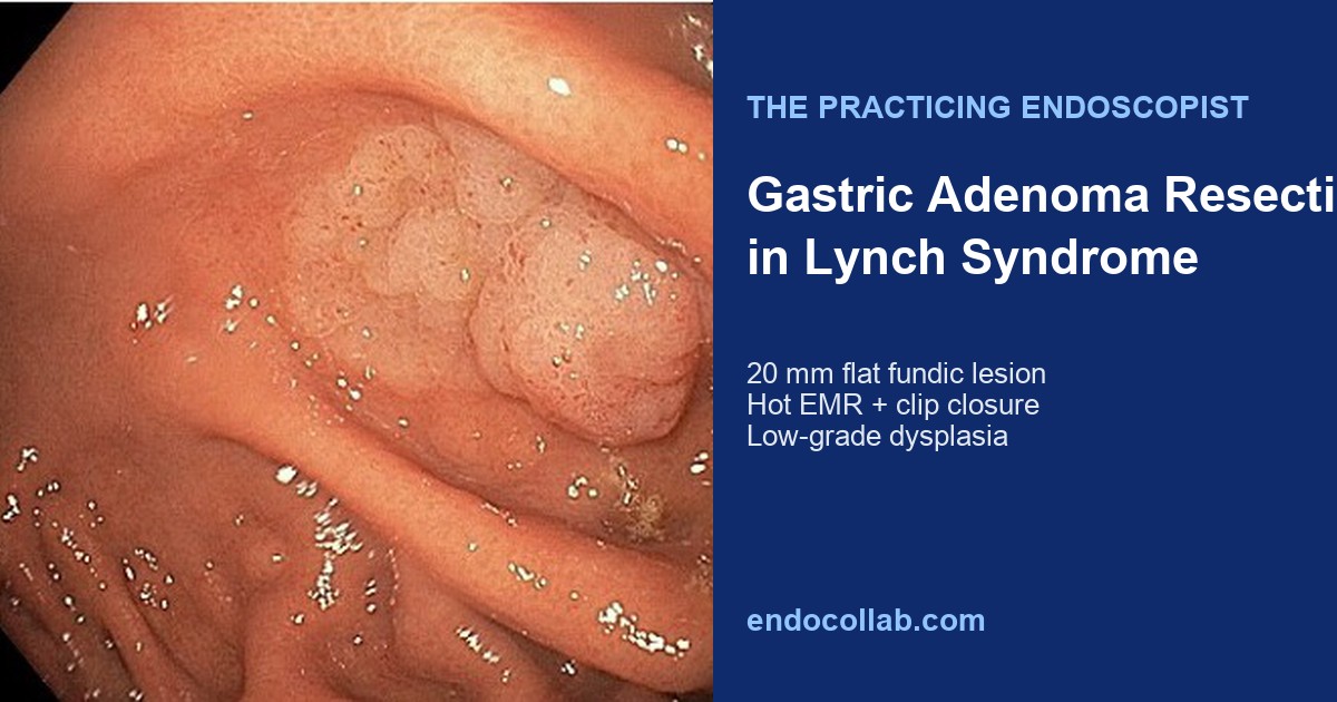 Gi Endoscopy Community &Amp; Education - Endocollab