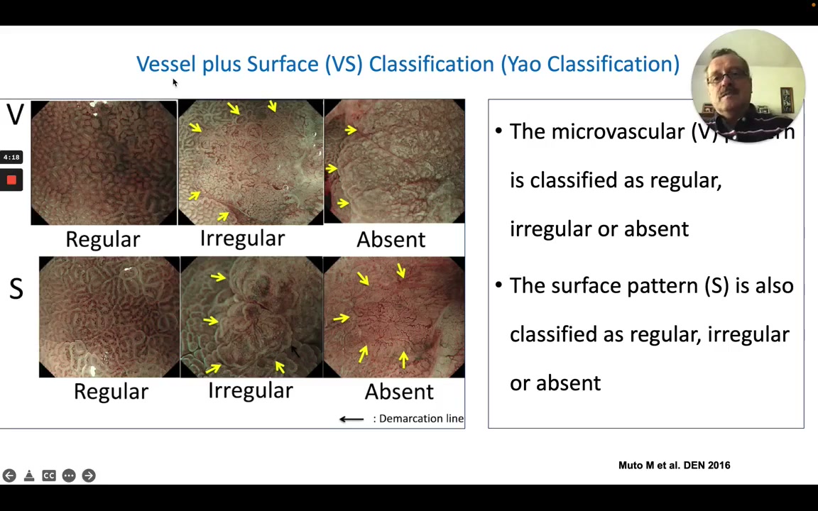 Yao Vessel-Plus-Surface Vs Classification Grid: Regular, Irregular, Or Absent