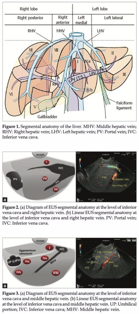 A Practical Approach To Eus Liver Examination 21 A Practical Approach To Eus Liver Examination