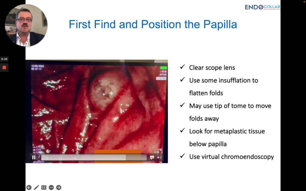 Basic Ercp: Principles Of Bile Duct Cannulation