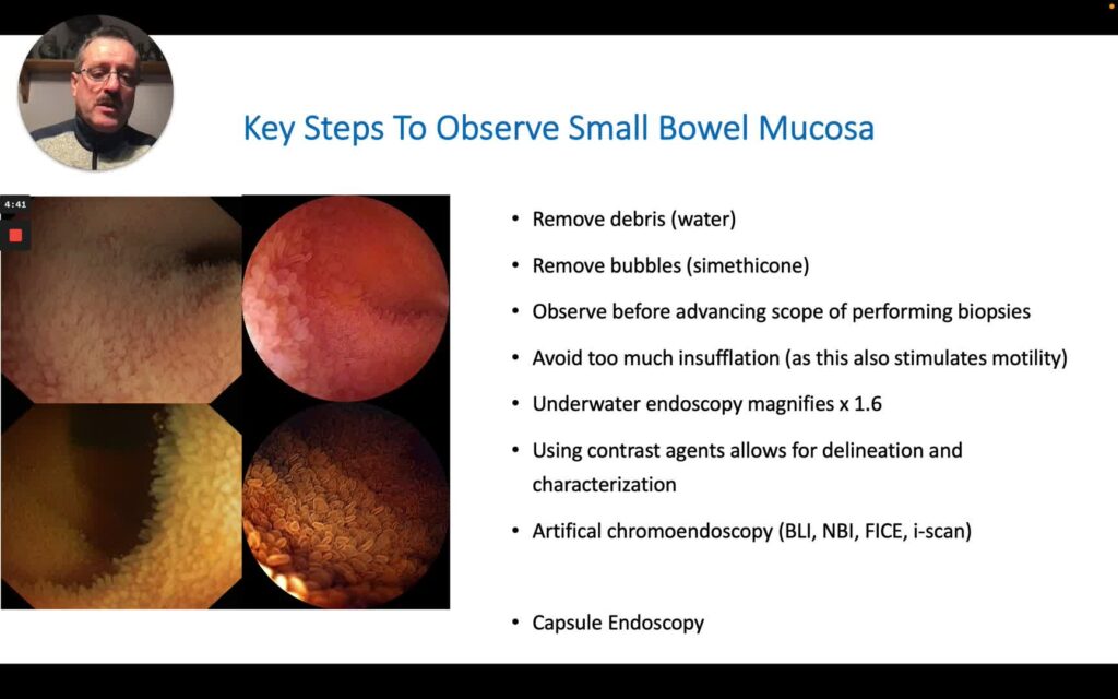 Basic Small Bowel Mucosal Inspection 1 Basic Small Bowel Mucosal Inspection
