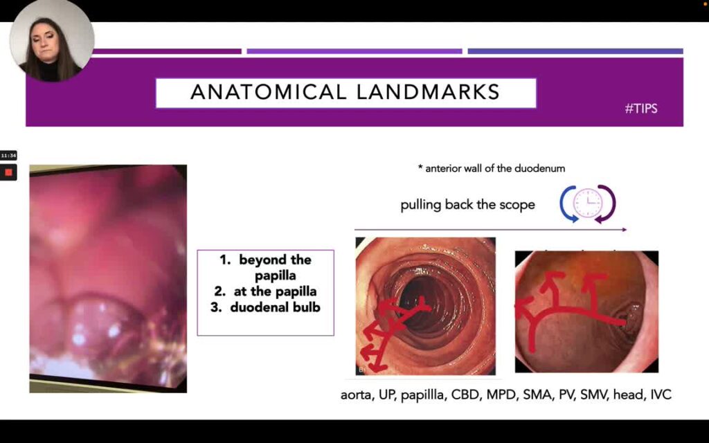 Basic Steps In Endoscopic Ultrasound 8 Basic Steps In Endoscopic Ultrasound