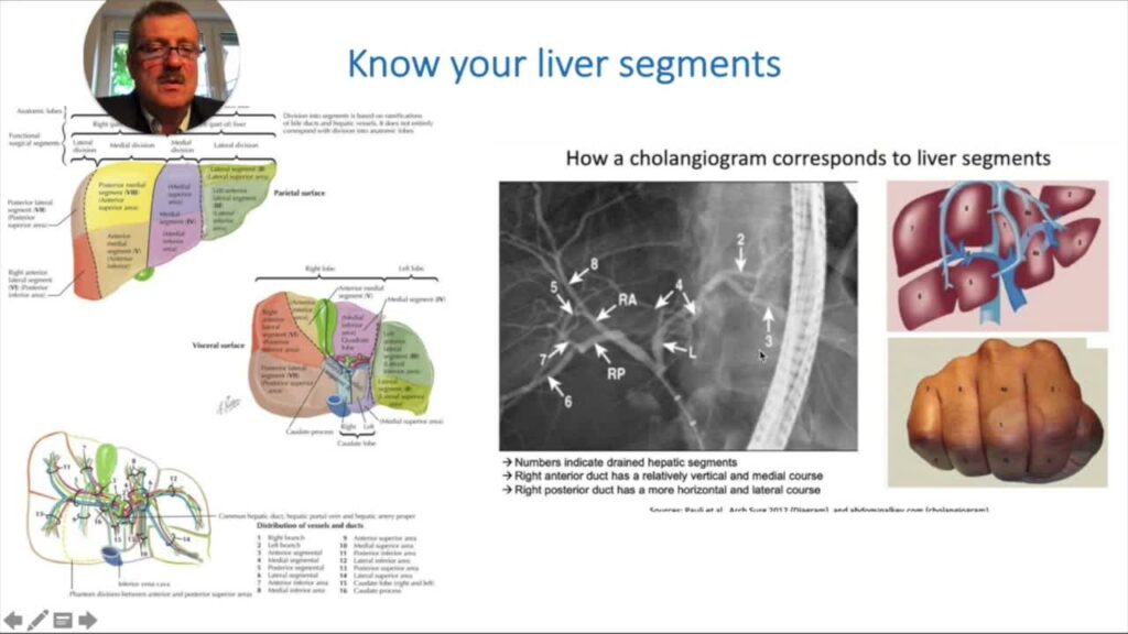 Bile Duct Strictures: A Practical Approach (Part 1)
