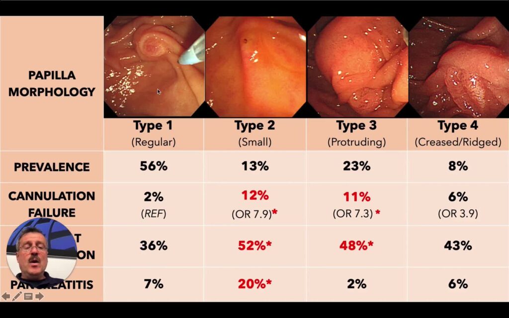 Biliary Sphincterotomy – A Quick Tip Explanation