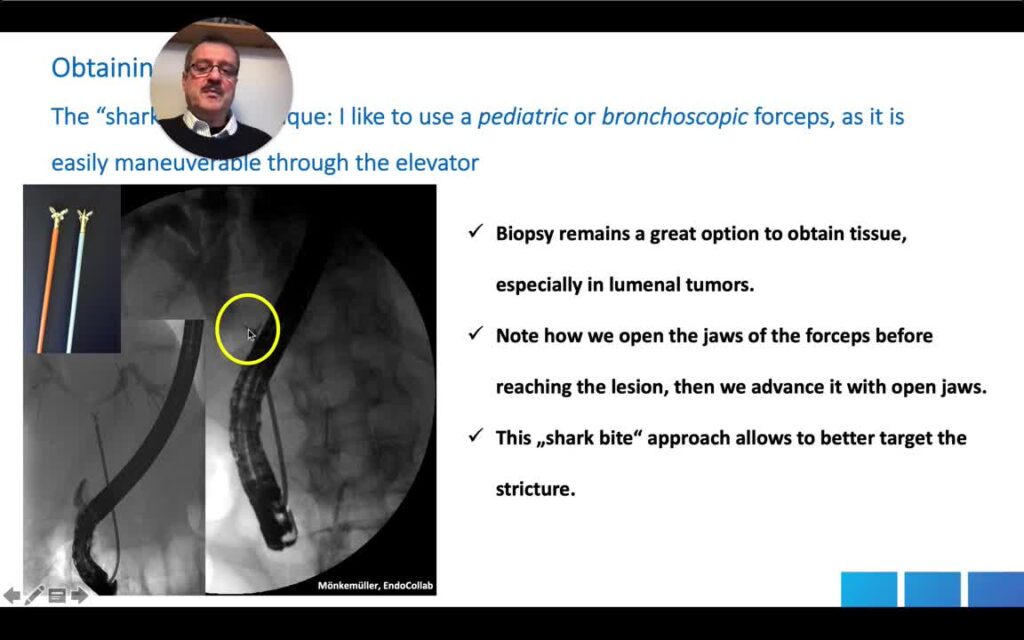 Biopsies During ERCP