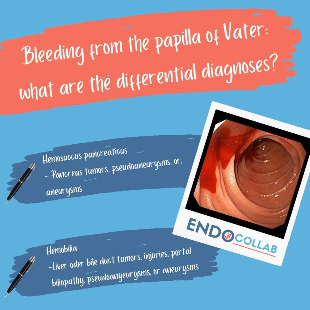 Bleeding From The Papilla Of Vater