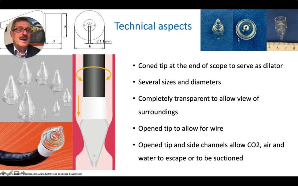 Cap Distal Transparente Para Dilatación (“Bougie Cap” De Ovesco)