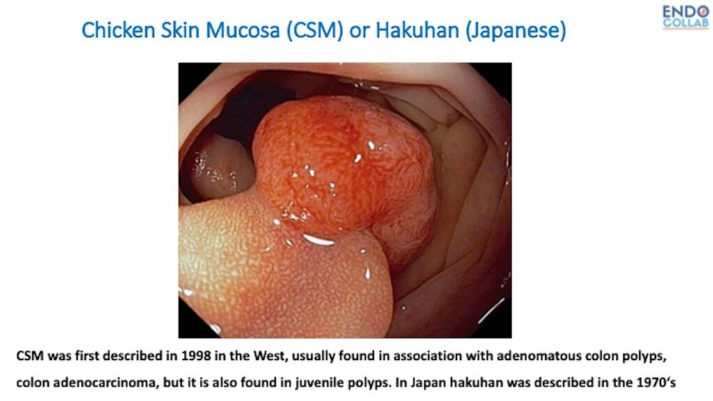 Chicken Skin Mucosa Or Hakuhan 4 Chicken Skin Mucosa Or Hakuhan