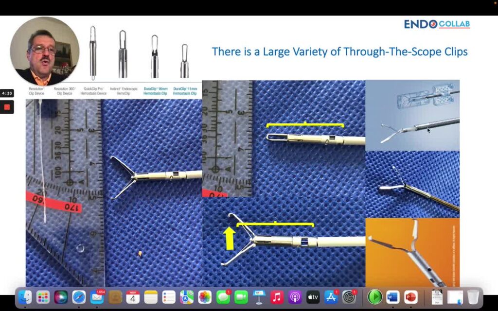 Clips For Hemostasis 1 Clips For Hemostasis