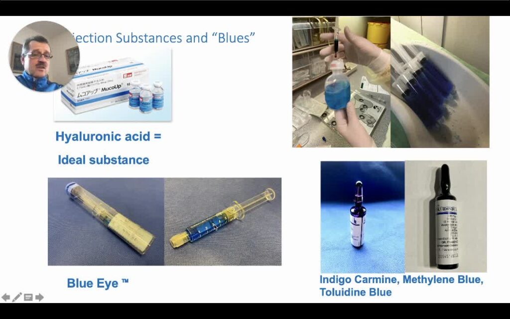 How To Create The Submucosal Injection Solution With Blue Dye