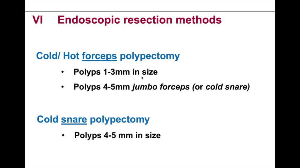 Colon Polypectomy – State-Of-The-Art