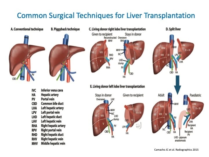 Common Surgical Techniques