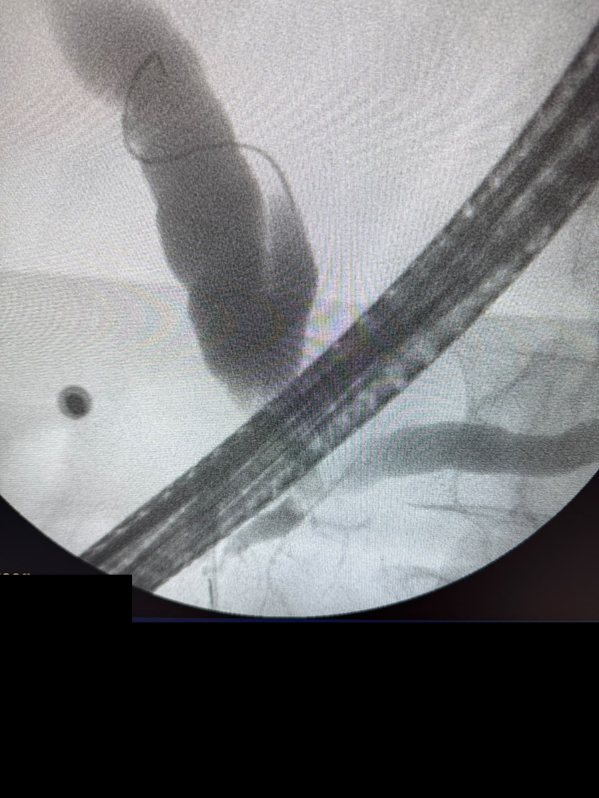 Gi Endoscopy Community &Amp; Education - Endocollab