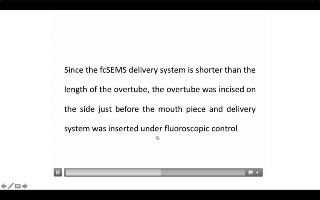 Device-Assisted ERCP โ Novel Technique to Insert Large Caliber Stents (incl. SEMS)