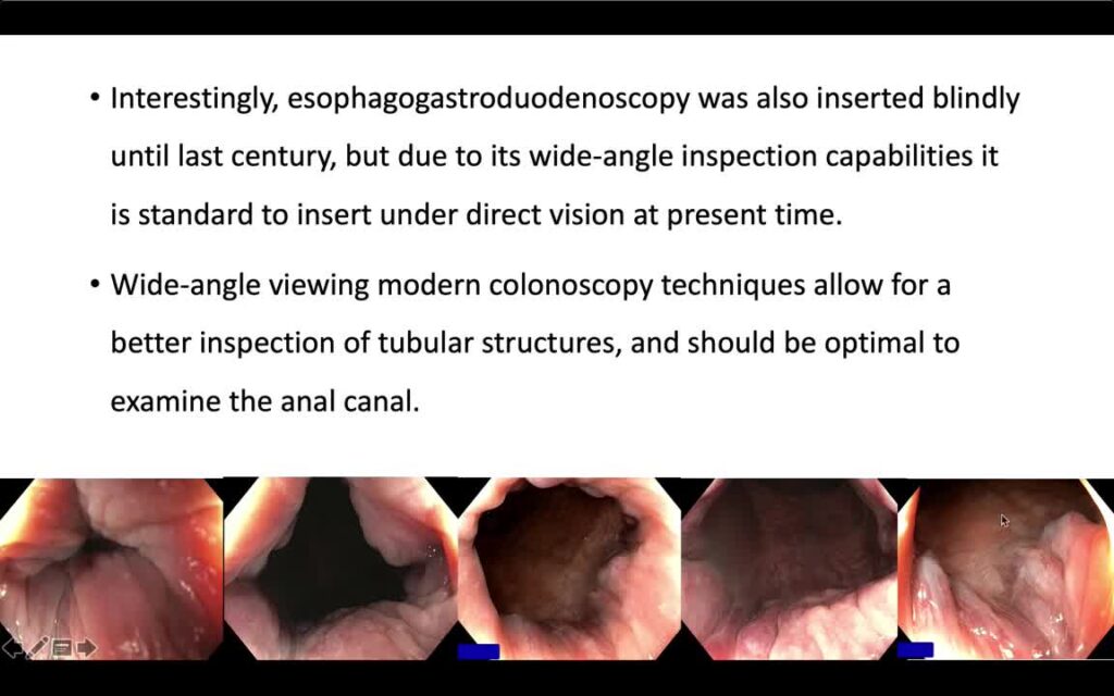Direct Anorectal Intubation During Colonoscopy