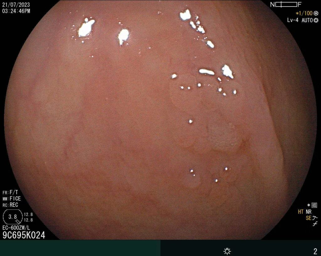 Dynamic Injection/Emr Conventional