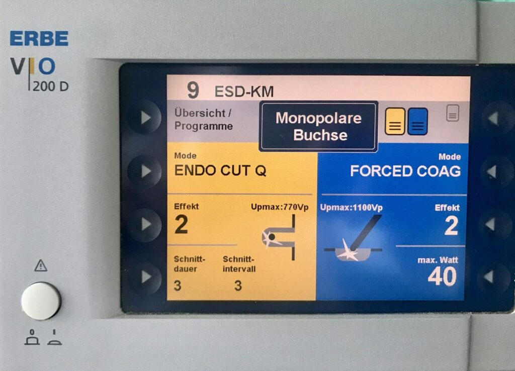 Electrosurgical Settings For Esd – These Are The Settings I Use (Effect 2, Duration 3, Interval 3) -And Forced Coagulation (Effect 2, 40 W)