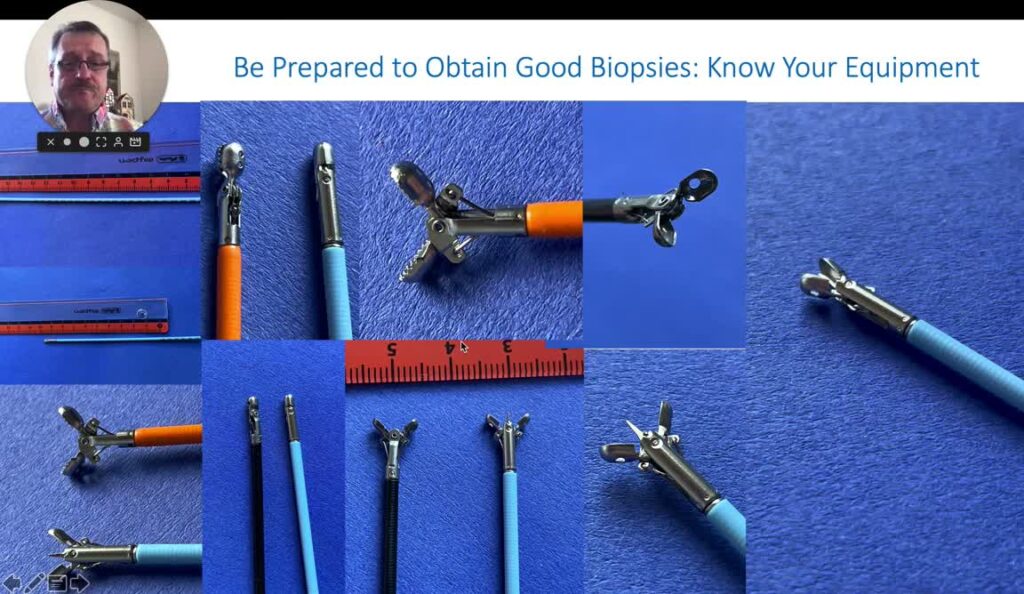 Endoscopic Biopsies – The Essentials