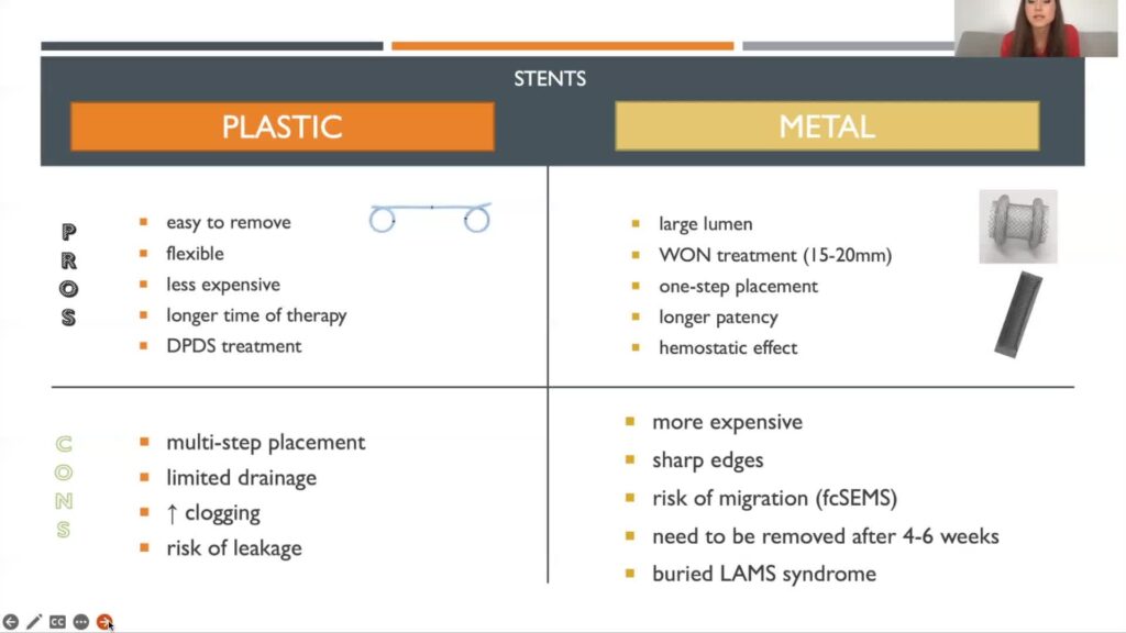 Endoscopic Drainage Of Pancreatic Fluid Collections: Plastic Or Metal Stent? By Dr. Katarzyna Monika Pawlak