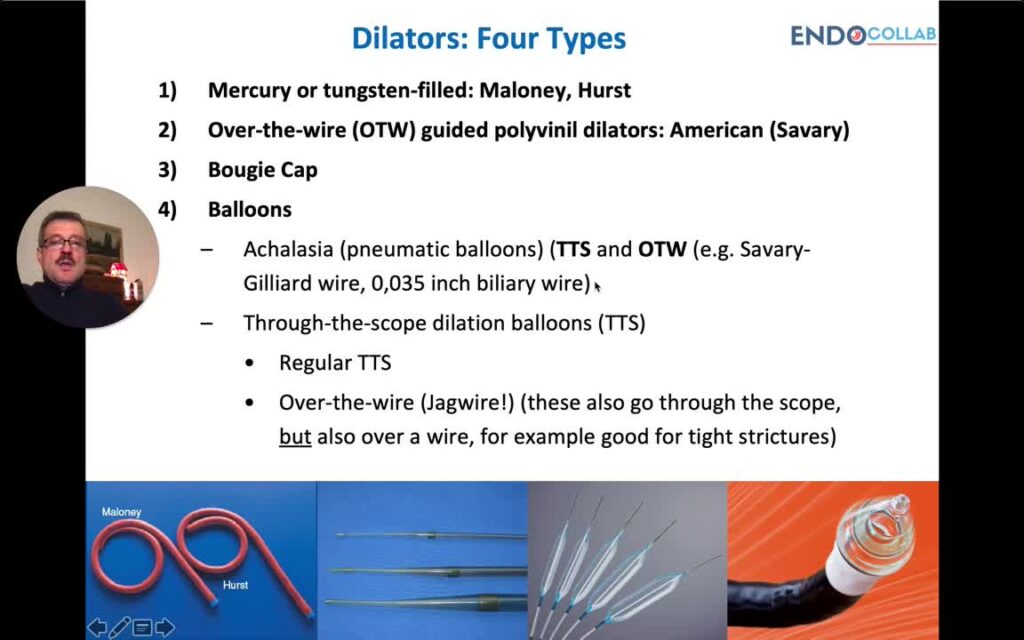 Endoscopic Management Of Esophageal Strictures – Three Essential Steps