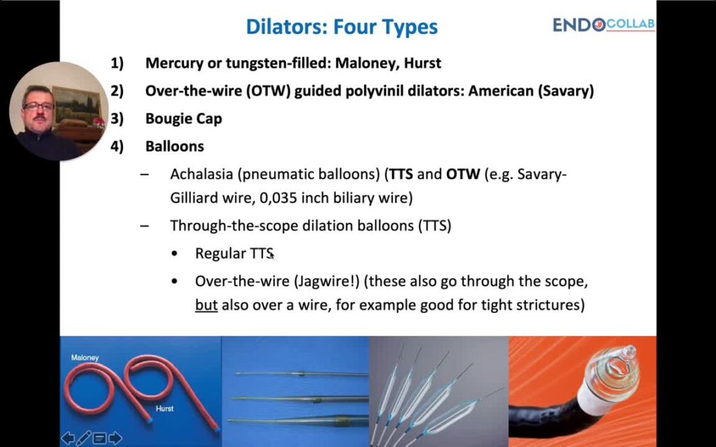 Endoscopic Management Of Esophageal Strictures: Three Essential Steps