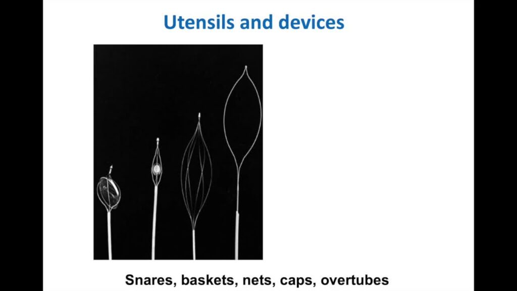 Endoscopic Management of Foreign Bodies (part 1)