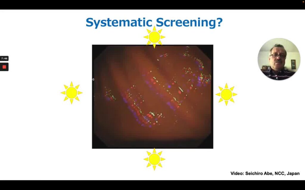 Endoscopic Screening For Early Gastric Cancer