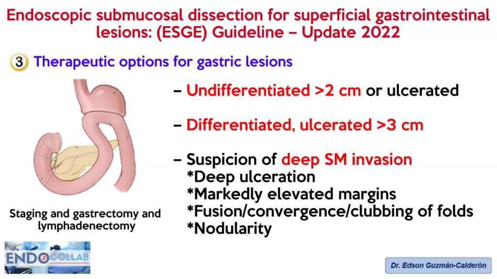 Endoscopic Submucosal Dissection For Superficial Gastrointestinal Lesions: Esge Guideline – 2022 By Dr Edson Guzman Calderon