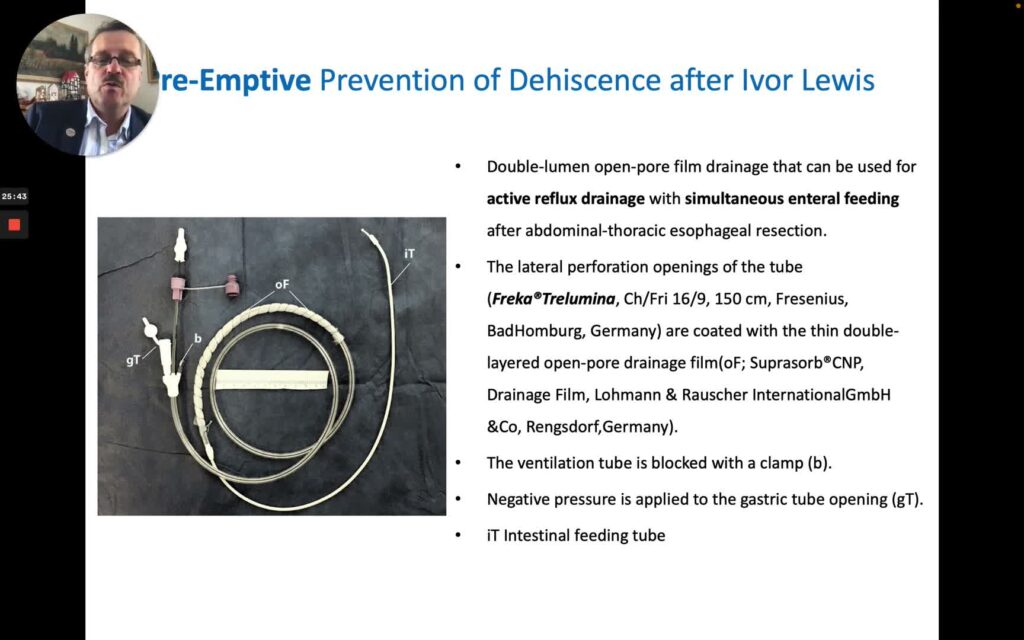 Endoscopic Vacuum Therapy – Advances And Evolution