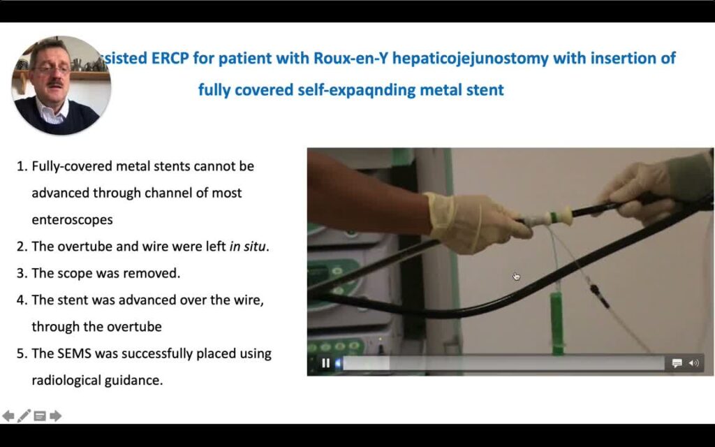 Enterosopy In Patients With Surgically Altered Upper Gi Tract Anatomy 6 Enterosopy In Patients With Surgically Altered Upper Gi Tract Anatomy