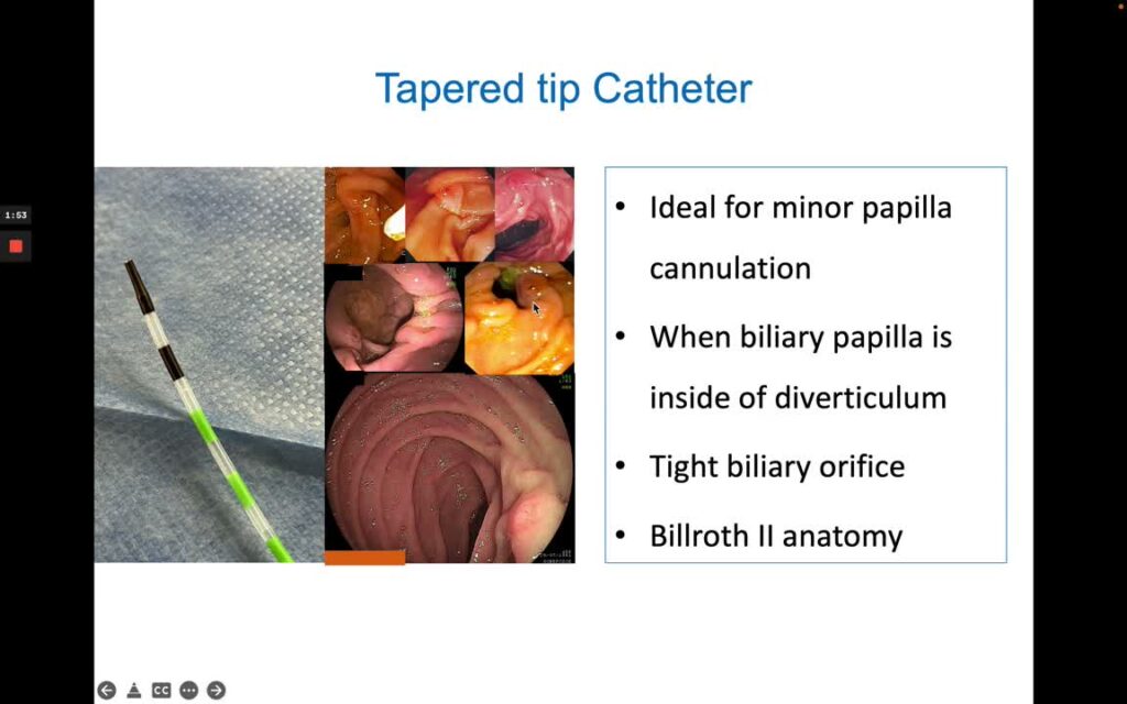 Ercp Cannulation- Bowing The Biliary Catheter 2 Ercp Cannulation- Bowing The Biliary Catheter
