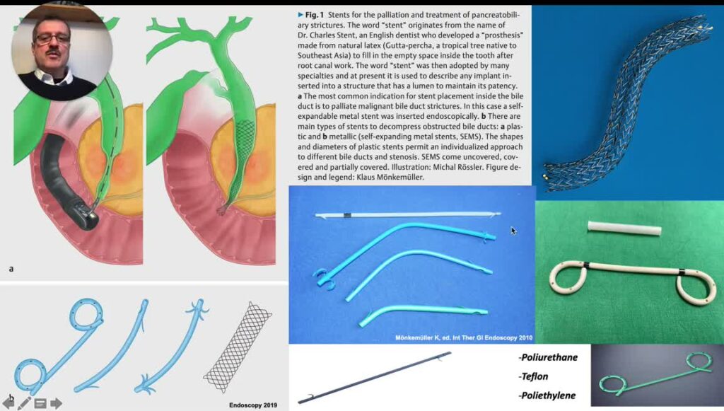 Ercp – Endoscopic Management Of Proximal Malignant Bile Duct Strictures