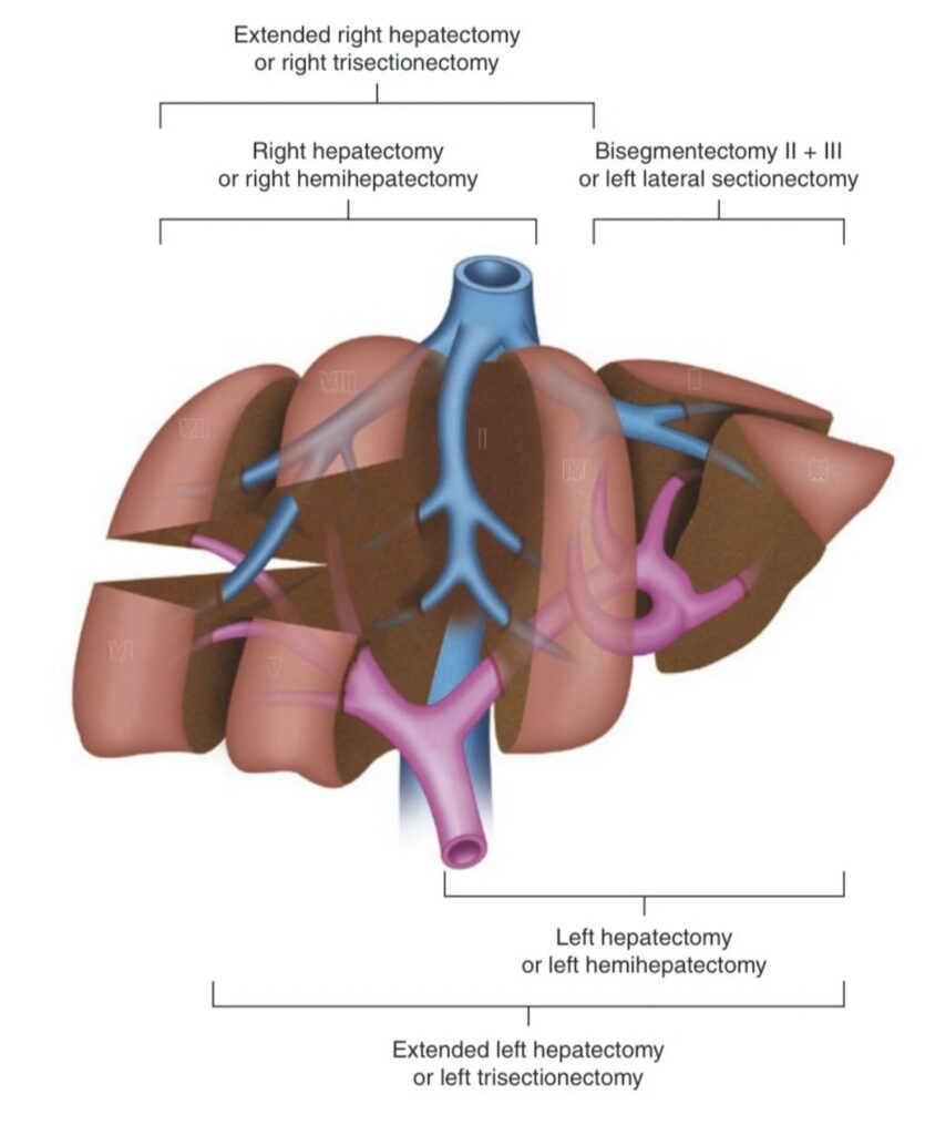 ERCP – Liver Surgery Series: Liver Segmentation Lesson