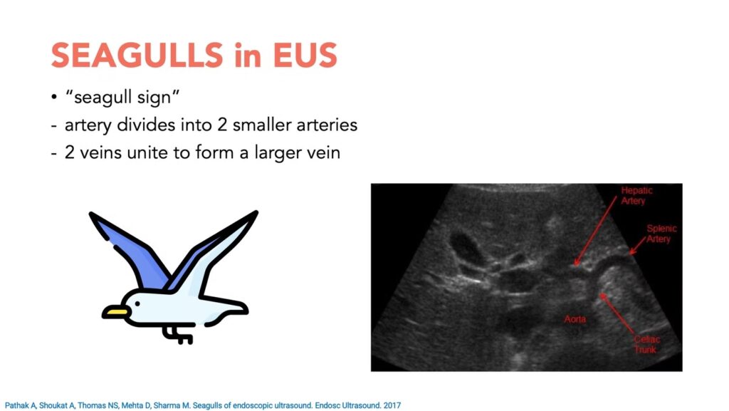 Eus &Quot;Seagulls&Quot; 17 Eus “Seagulls”