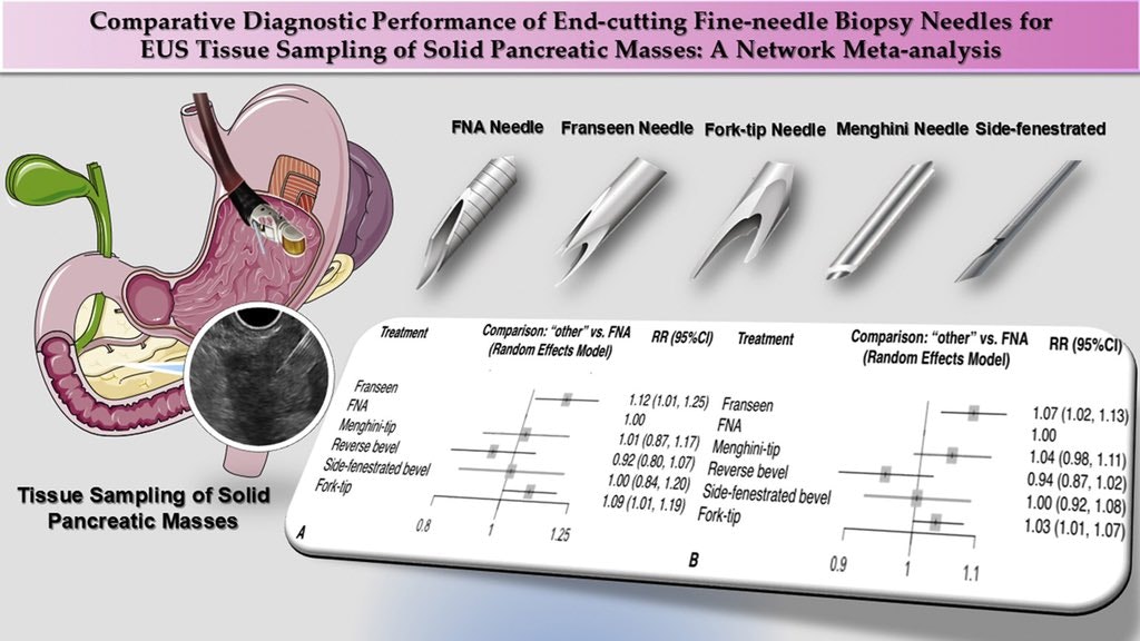Fine Needle Biopsy Needles Studied In Meta-Analysis: Franseen And Fork-Tip Win 13 Fine Needle Biopsy Needles Studied In Meta-Analysis: Franseen And Fork-Tip Win