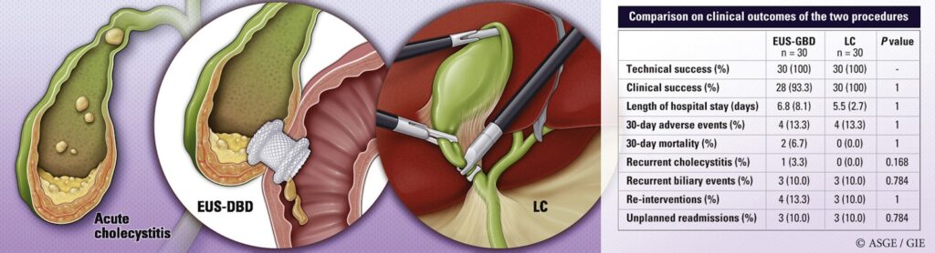 Gallbladder Drainage
