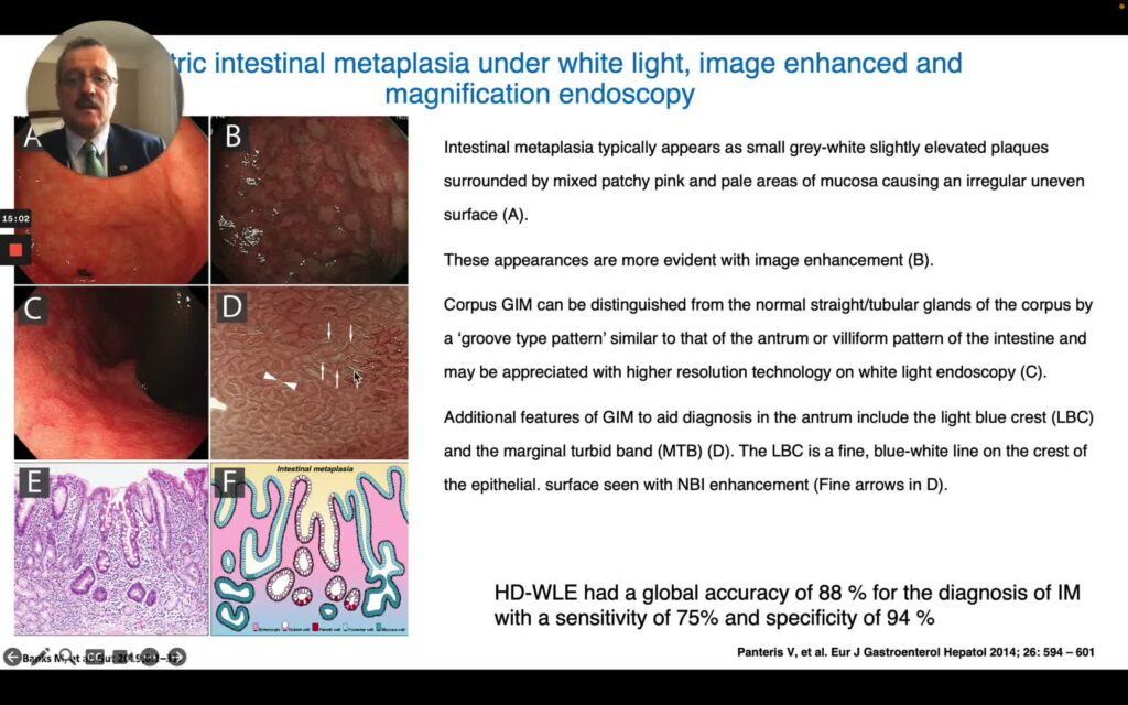 Gastric Atrophy and Intestinal Metaplasia: Diagnosis and Patient Selection for Surveillance