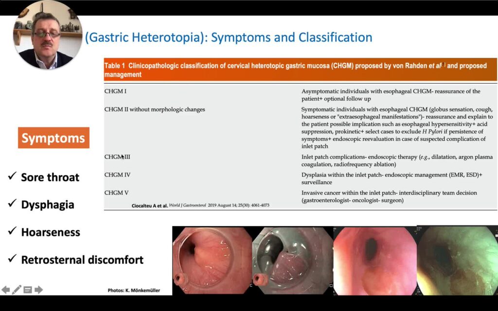 How To Biopsy Esophageal Inlet Patch