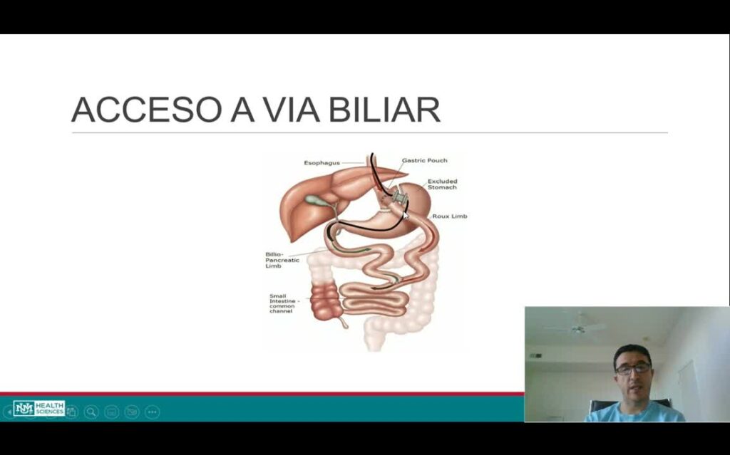Intervenciones Con Ultrasonido Endoscópico Por El Prof. Dr. Antonio Mendoza Ladd