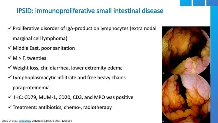 Ipsid (Immunproliferative Small Intestinal Disease) 11 Ipsid (Immunproliferative Small Intestinal Disease)